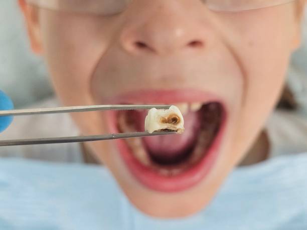 Best Emergency Gum Treatment in Rkside, PA